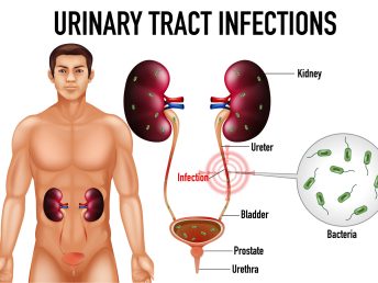 Informative illustration of urinary tract infections illustration