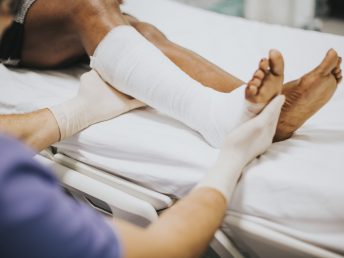 Doctor helping a patient with a fractured leg