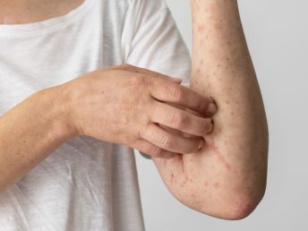 skin-allergy-reaction-person-s-arm
